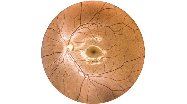 An aye for a healthy eye