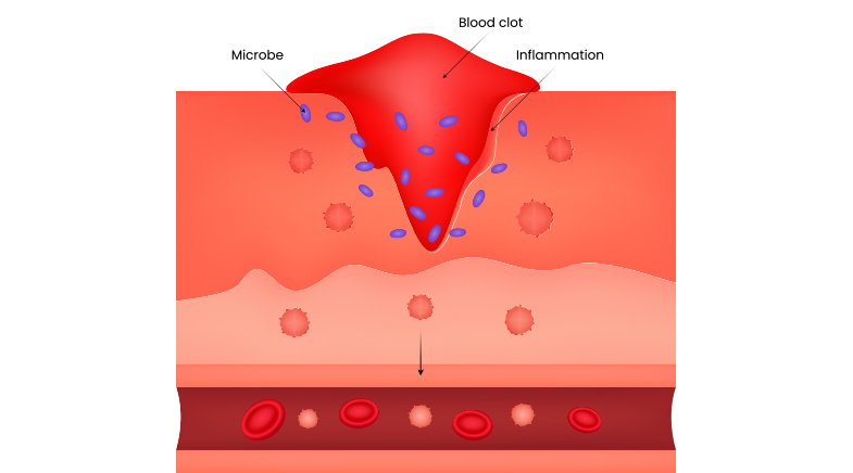 Patching skin with bioink