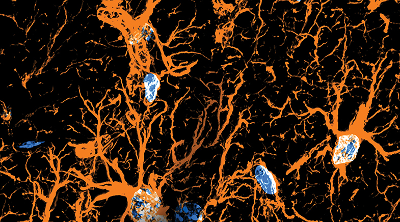 Brain&#039;s unsung heroes