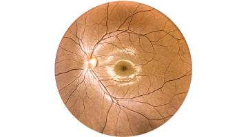 An aye for a healthy eye