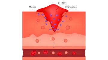 Patching skin with bioink