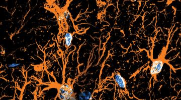 Brain's unsung heroes Brain's unsung heroes
