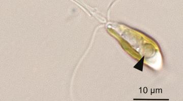 A new organelle on the block